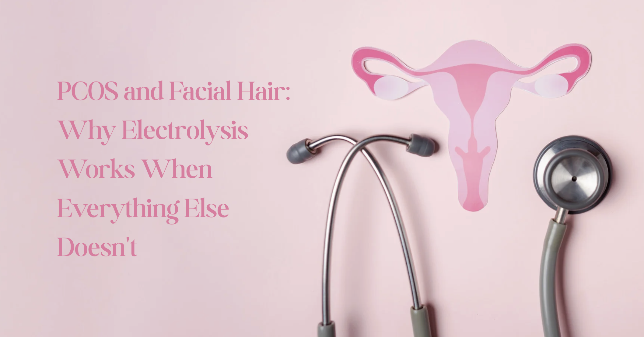 PCOS and Facial Hair: Why Electrolysis Works When Everything Else Doesn't