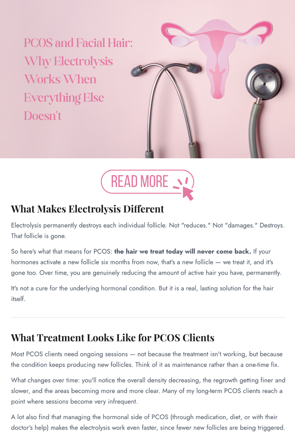 PCOS and Facial Hair: Why Electrolysis Works When Everything Else Doesn't