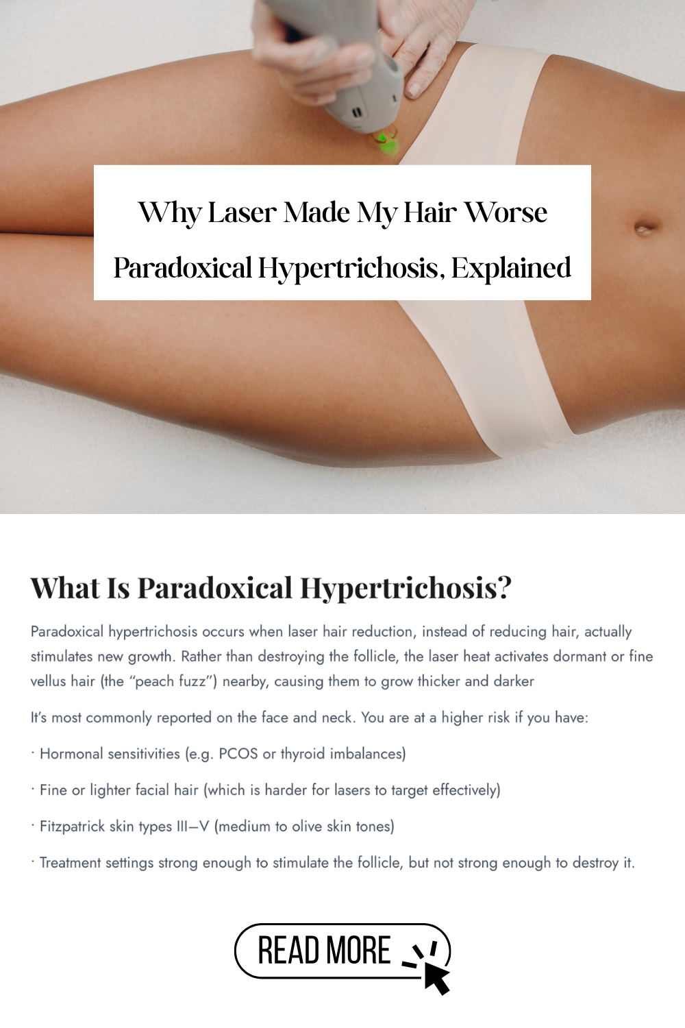 Why Laser Made My Hair Worse (Paradoxical Hypertrichosis, Explained)